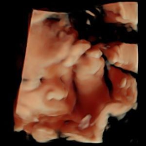 Meet your Posher, Akima